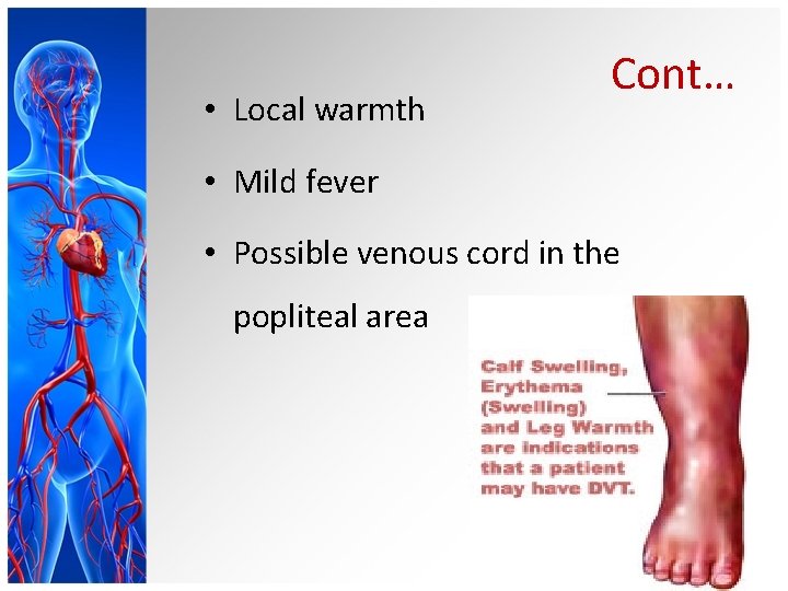  • Local warmth Cont… • Mild fever • Possible venous cord in the