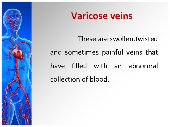 Varicose veins These are swollen, twisted and sometimes painful veins that have filled with