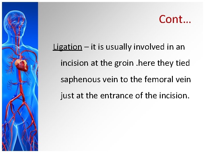 Cont… Ligation – it is usually involved in an incision at the groin. here