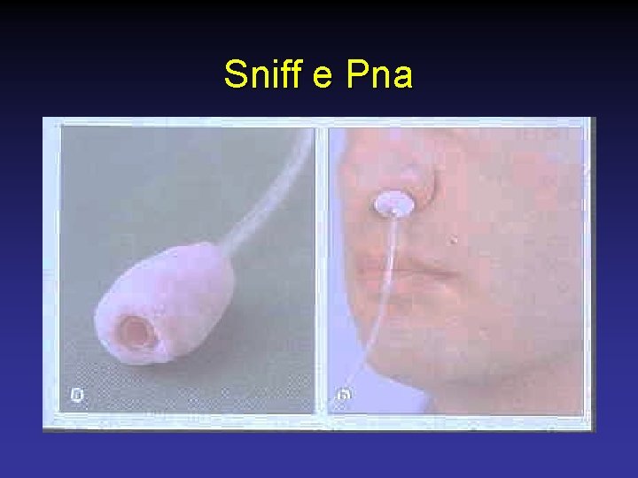 Sniff e Pna 