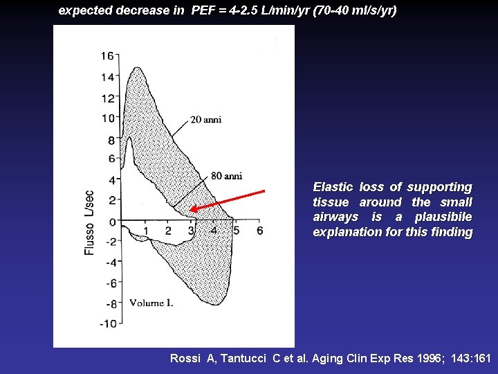 expected decrease in PEF = 4 -2. 5 L/min/yr (70 -40 ml/s/yr) Elastic loss