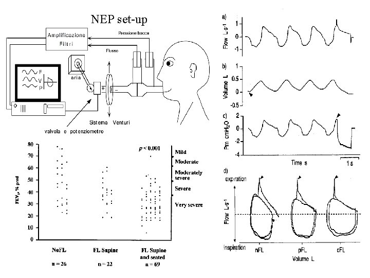 NEP set-up 