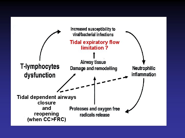 Tidal expiratory flow limitation ? Tidal dependent airways closure and reopening (when CC>FRC) 