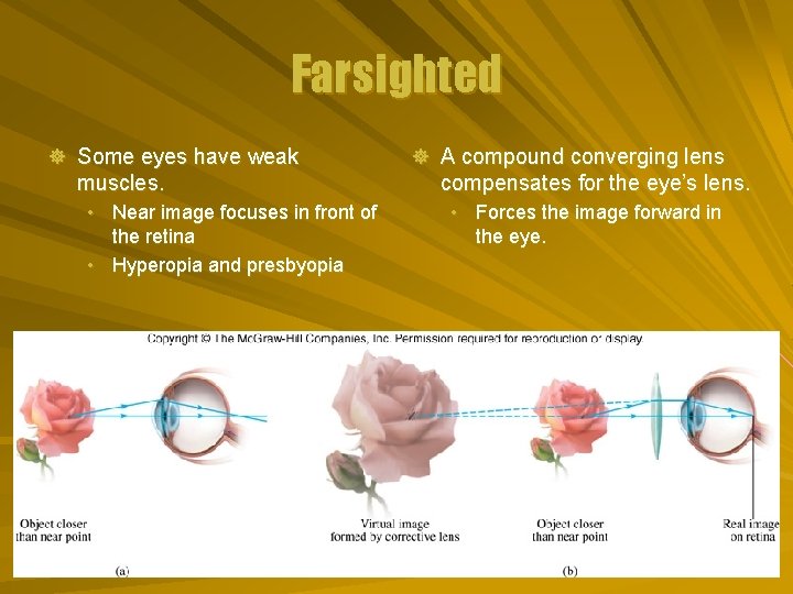 Farsighted ] Some eyes have weak muscles. • Near image focuses in front of