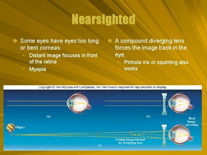 Nearsighted ] Some eyes have eyes too long or bent corneas. • Distant image