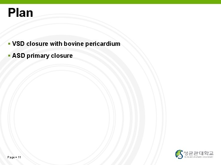 Plan VSD closure with bovine pericardium ASD primary closure Page 11 YOUR LOGO 