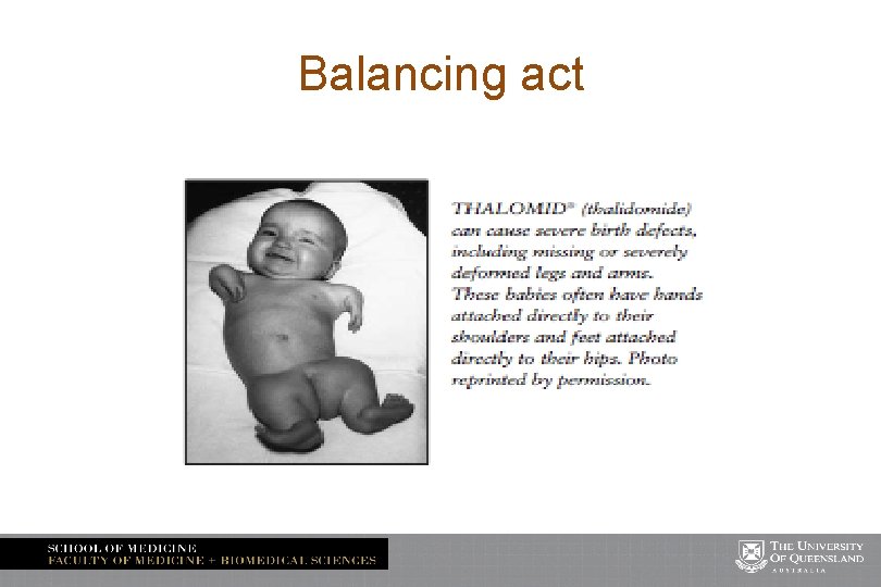 Balancing act 