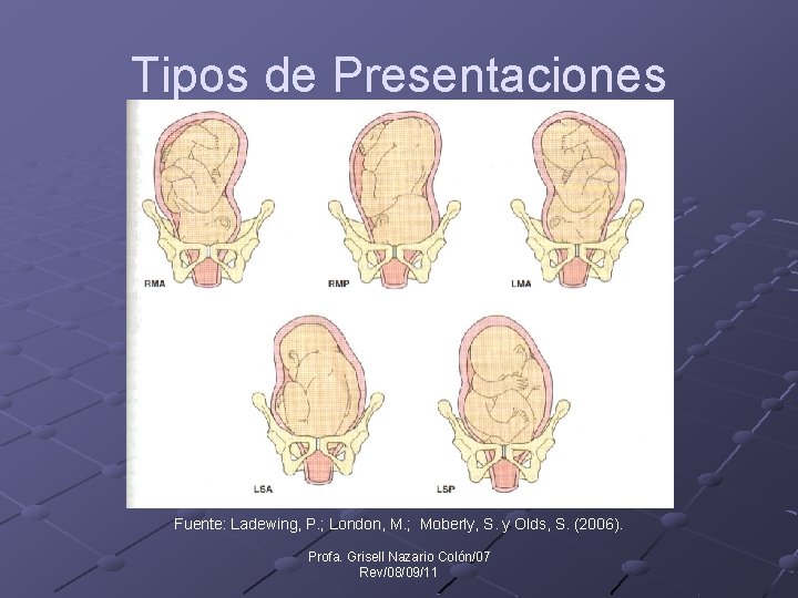 Tipos de Presentaciones Fuente: Ladewing, P. ; London, M. ; Moberly, S. y Olds,