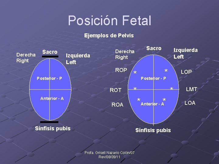 Posición Fetal Ejemplos de Pelvis Derecha Right Sacro Izquierda Left Sacro Derecha Right ROP