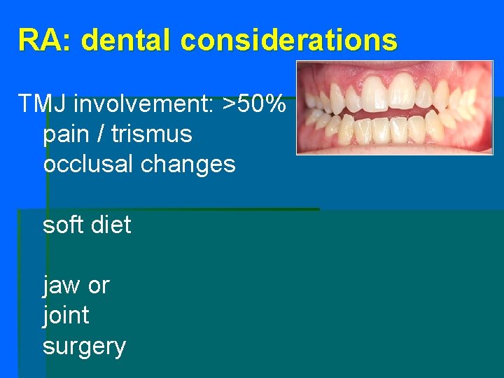 RA: dental considerations TMJ involvement: >50% pain / trismus occlusal changes soft diet jaw RA: dental considerations TMJ involvement: >50% pain / trismus occlusal changes soft diet jaw