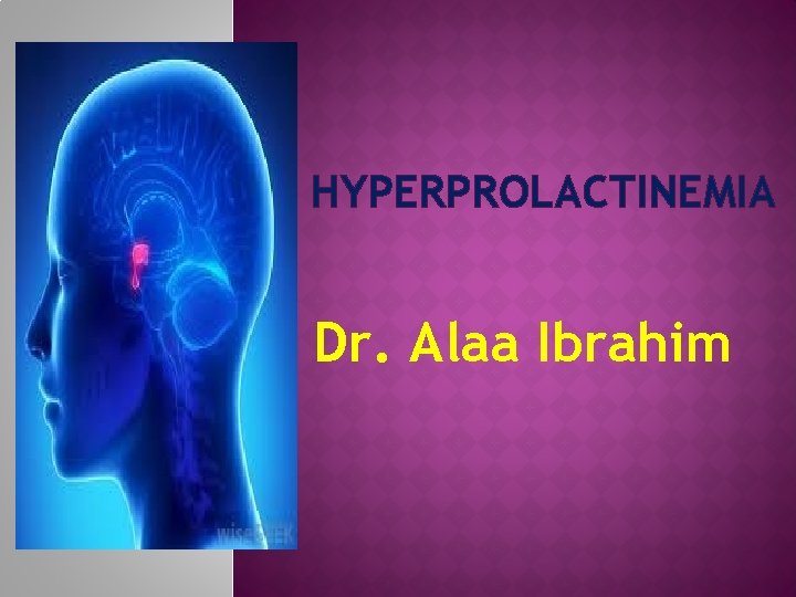 HYPERPROLACTINEMIA Dr. Alaa Ibrahim 