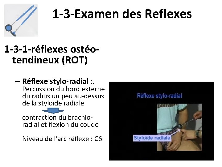 1 -3 -Examen des Reflexes 1 -3 -1 -réflexes ostéotendineux (ROT) – Réflexe stylo-radial