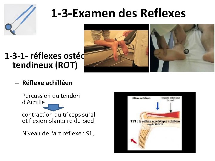 1 -3 -Examen des Reflexes 1 -3 -1 - réflexes ostéotendineux (ROT) – Réflexe