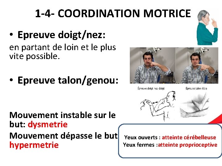 1 -4 - COORDINATION MOTRICE • Epreuve doigt/nez: en partant de loin et le