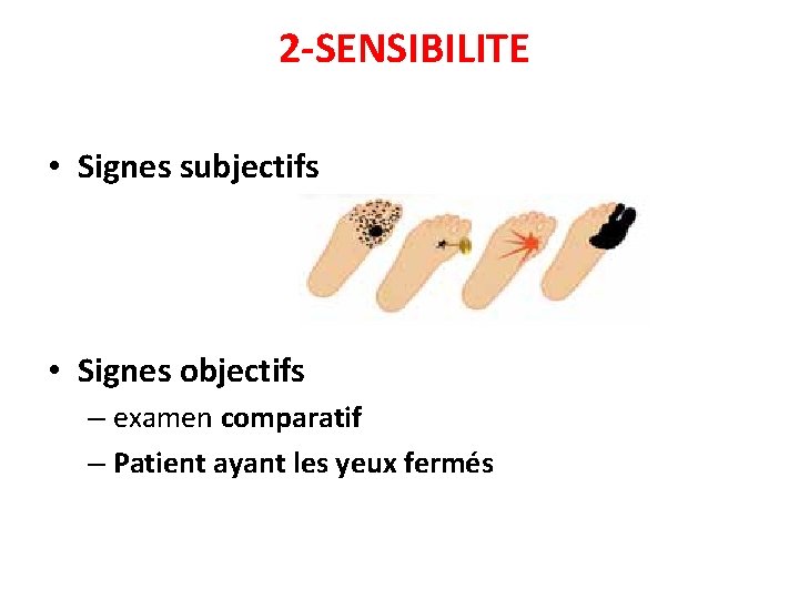 2 -SENSIBILITE • Signes subjectifs • Signes objectifs – examen comparatif – Patient ayant