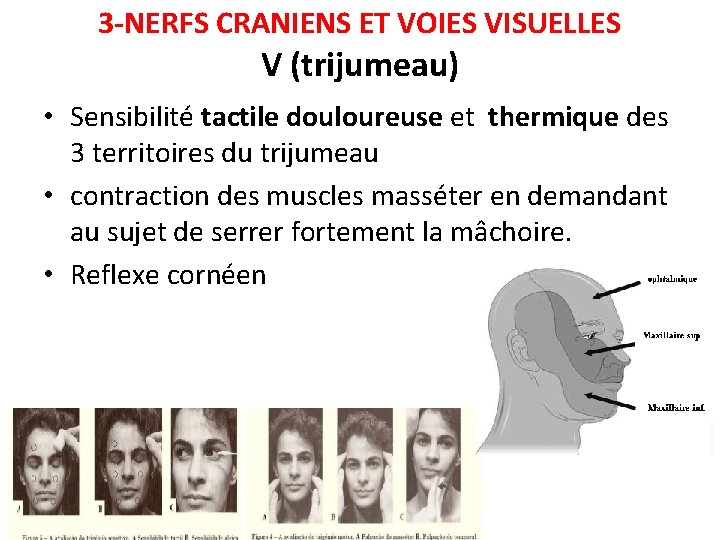 3 -NERFS CRANIENS ET VOIES VISUELLES V (trijumeau) • Sensibilité tactile douloureuse et thermique