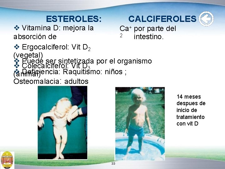 CALCIFEROLES ESTEROLES: Vitamina D: mejora la Ca+ por parte del 2 intestino. absorción de