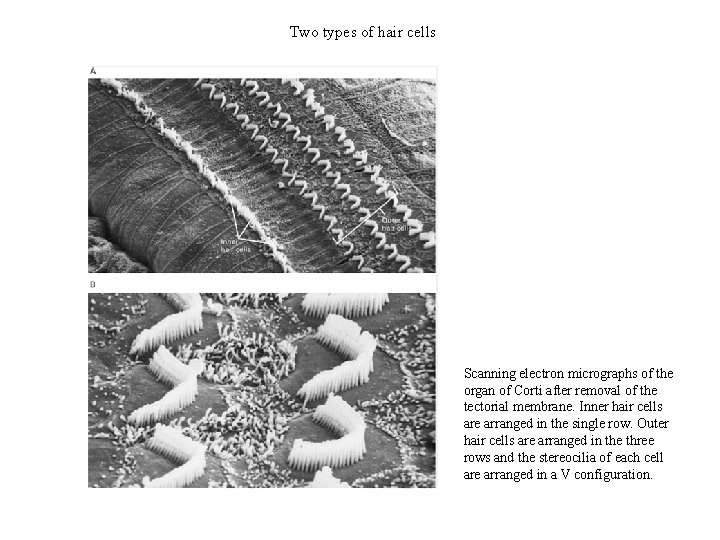 Two types of hair cells Scanning electron micrographs of the organ of Corti after
