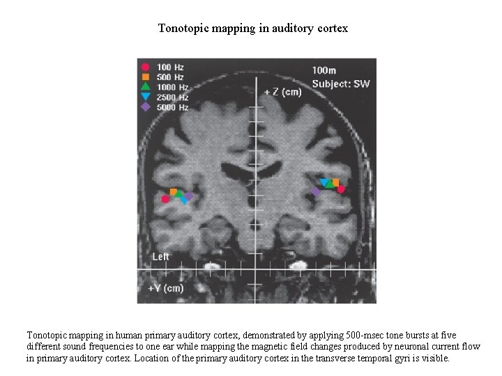 Tonotopic mapping in auditory cortex Tonotopic mapping in human primary auditory cortex, demonstrated by