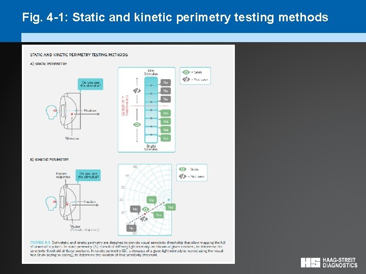 Fig. 4 -1: Static and kinetic perimetry testing methods 