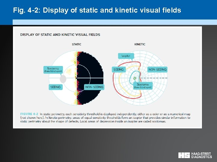 Fig. 4 -2: Display of static and kinetic visual fields 