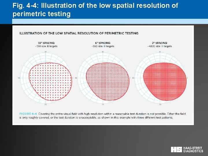 Fig. 4 -4: Illustration of the low spatial resolution of perimetric testing 