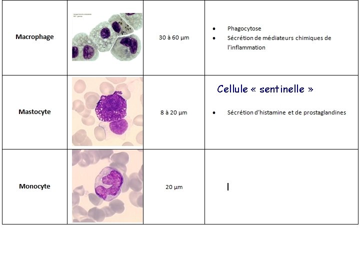 Cellule « sentinelle » 