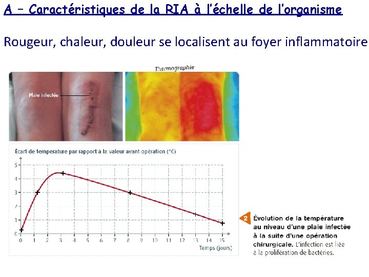 A – Caractéristiques de la RIA à l’échelle de l’organisme Rougeur, chaleur, douleur se