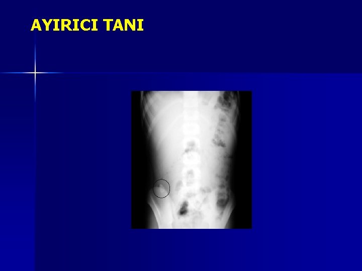 AYIRICI TANI AYIRICI TANI