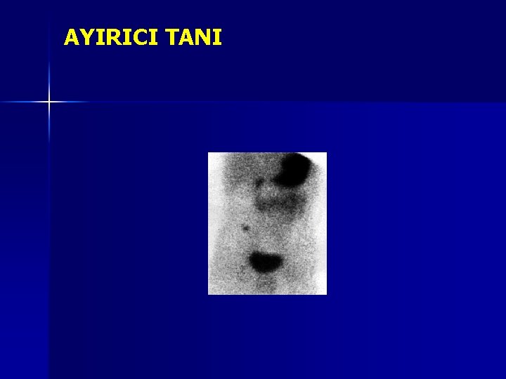 AYIRICI TANI AYIRICI TANI