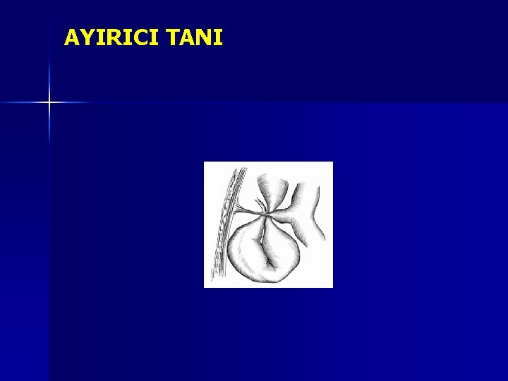 AYIRICI TANI AYIRICI TANI