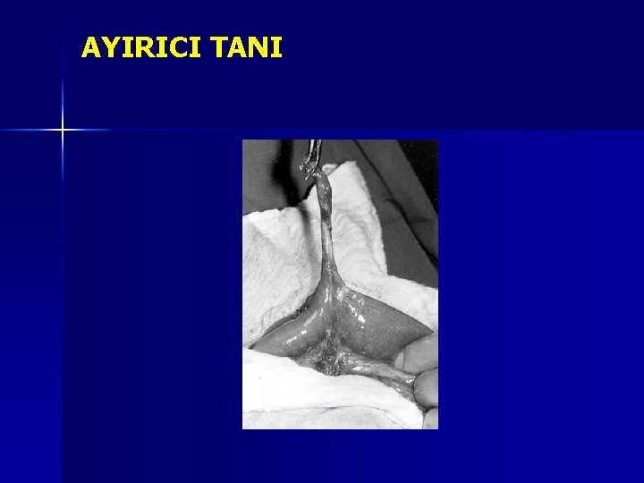 AYIRICI TANI AYIRICI TANI