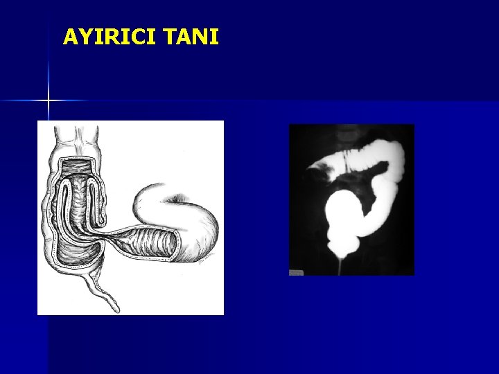 AYIRICI TANI AYIRICI TANI