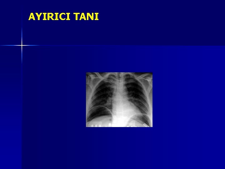 AYIRICI TANI AYIRICI TANI