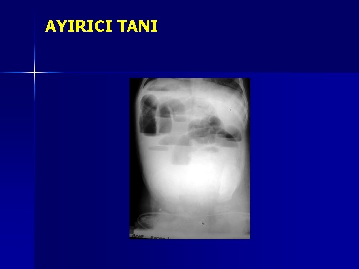 AYIRICI TANI AYIRICI TANI