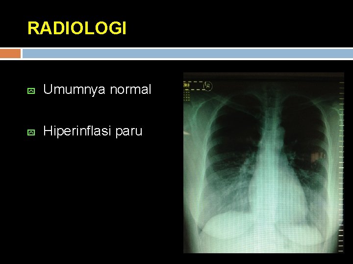 RADIOLOGI y Umumnya normal y Hiperinflasi paru 