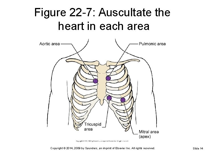 Figure 22 -7: Auscultate the heart in each area Copyright © 2014, 2009 by