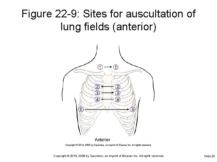 Figure 22 -9: Sites for auscultation of lung fields (anterior) Copyright © 2014, 2009