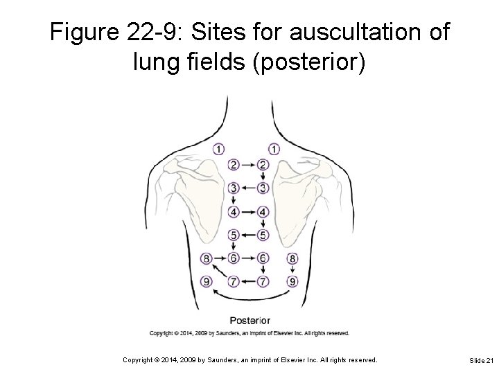 Figure 22 -9: Sites for auscultation of lung fields (posterior) Copyright © 2014, 2009
