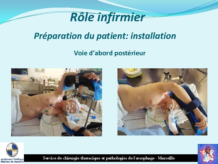 Rôle infirmier Préparation du patient: installation Voie d’abord postérieur Service de chirurgie thoracique et