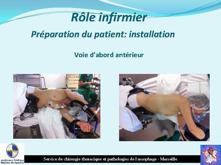 Rôle infirmier Préparation du patient: installation Voie d’abord antérieur Service de chirurgie thoracique et