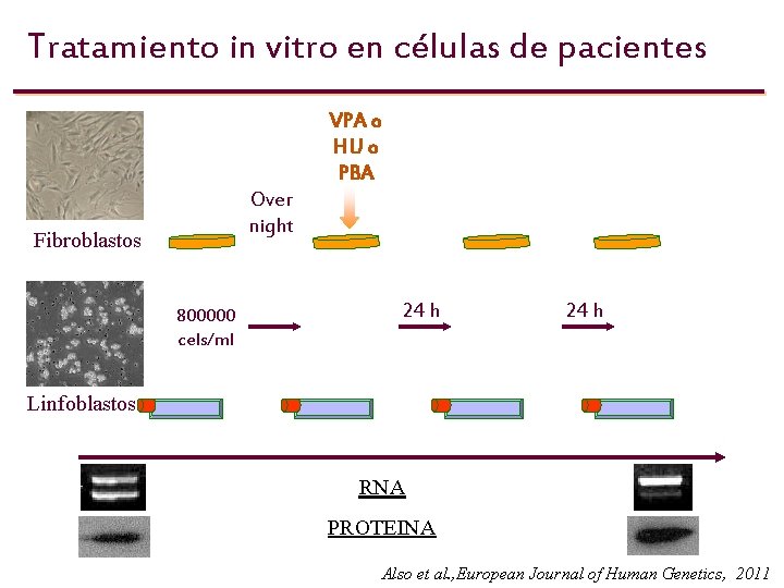 Tratamiento in vitro en células de pacientes VPA o HU o PBA Over night