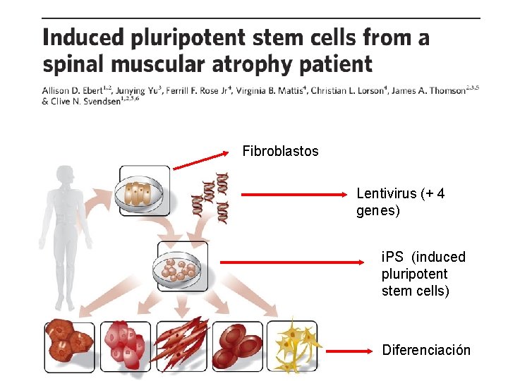 Fibroblastos Lentivirus (+ 4 genes) i. PS (induced pluripotent stem cells) Diferenciación 