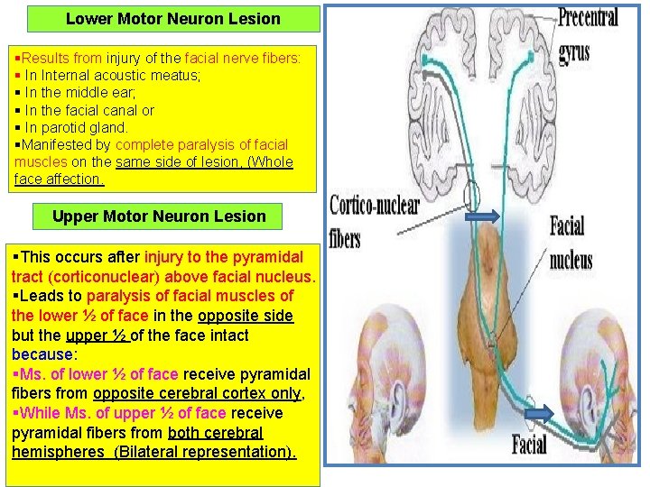Lower Motor Neuron Lesion §Results from injury of the facial nerve fibers: § In