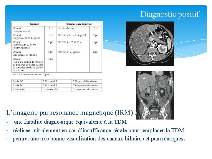 Diagnostic positif Score de Balthazar L’imagerie par résonance magnétique (IRM) : - une fiabilité