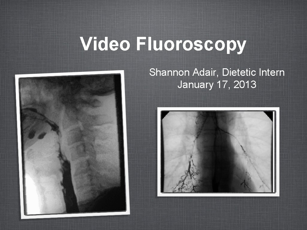 Video Fluoroscopy Shannon Adair, Dietetic Intern January 17, 2013 