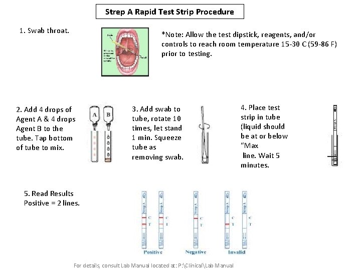 Strep A Rapid Test Strip Procedure 1. Swab throat. *Note: Allow the test dipstick,