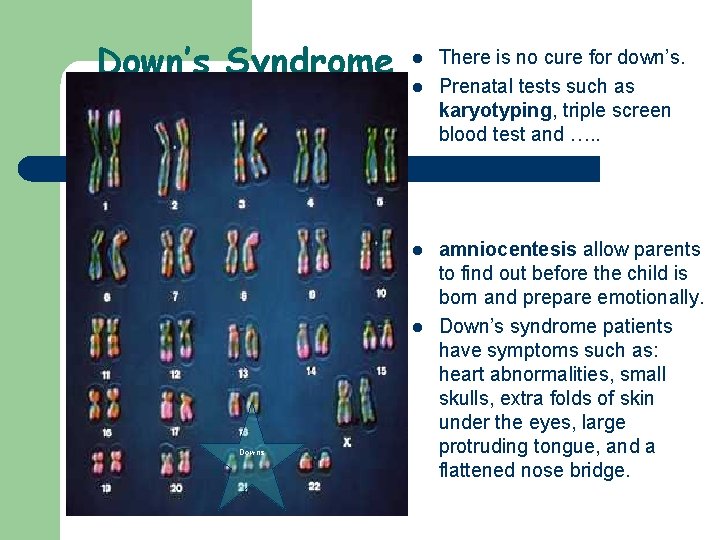 Down’s Syndrome l l Downs There is no cure for down’s. Prenatal tests such