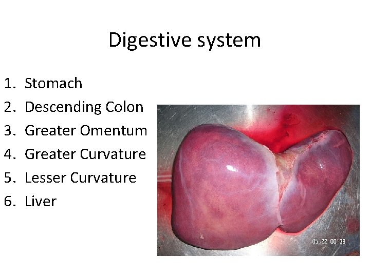 Digestive system 1. 2. 3. 4. 5. 6. Stomach Descending Colon Greater Omentum Greater