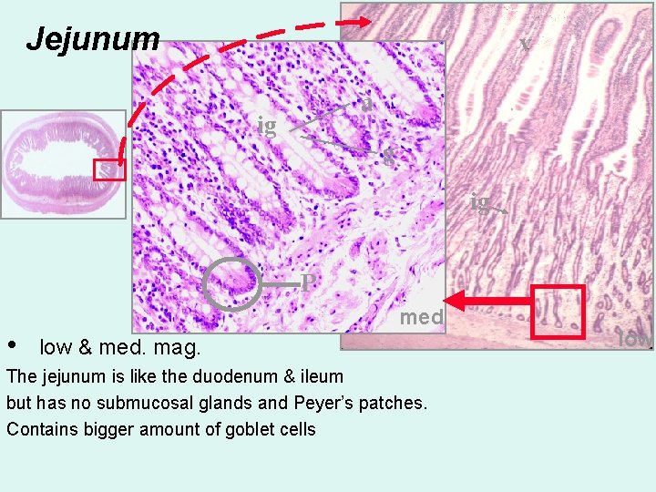 Jejunum v a ig g ig P • med low & med. mag. The